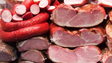 Estas carnes son altas en sodio, calorías y grasas. / Foto: Freepik