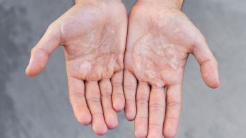 Evita propagar el Covid-19 limpiando tus manos. / Foto: Freepik.