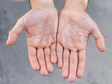 Evita propagar el Covid-19 limpiando tus manos. / Foto: Freepik.