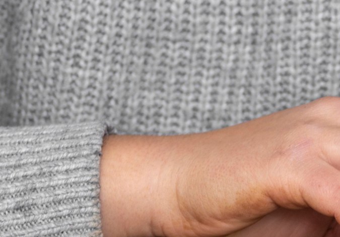 eliminar las pulgas de tu gato