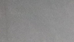 La obesidad es de por sí una enfermedad crónica. / Foto: Mufid Majnun - Unsplash.