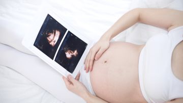 Qué problemas puede haber si un embarazo se pasa de la semana 40