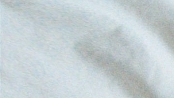 cómo tratar el acné del cuerpo para evitar manchas y cicatrices