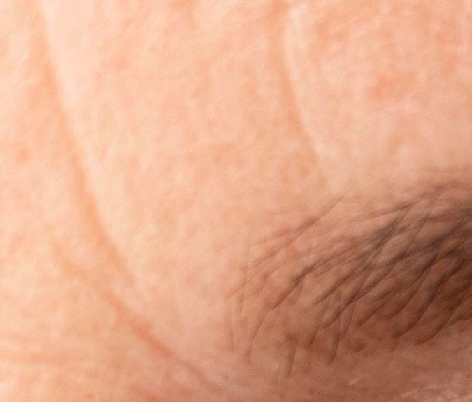 Cómo tratar los distintos tipos de arrugas que aparecen a partir de los 40 años de edad