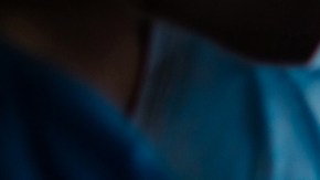 epidural durante el parto