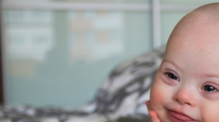 síndrome de Down en el embarazo