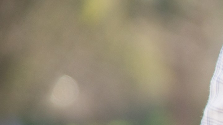 Cómo aliviar la inflamación intestinal