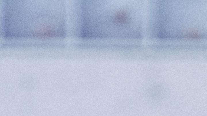 Variante Delta del Coronavirus