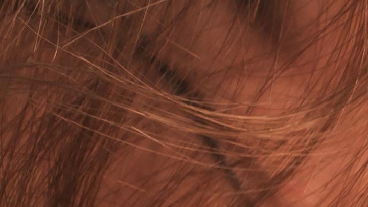 Protectores solares y cáncer