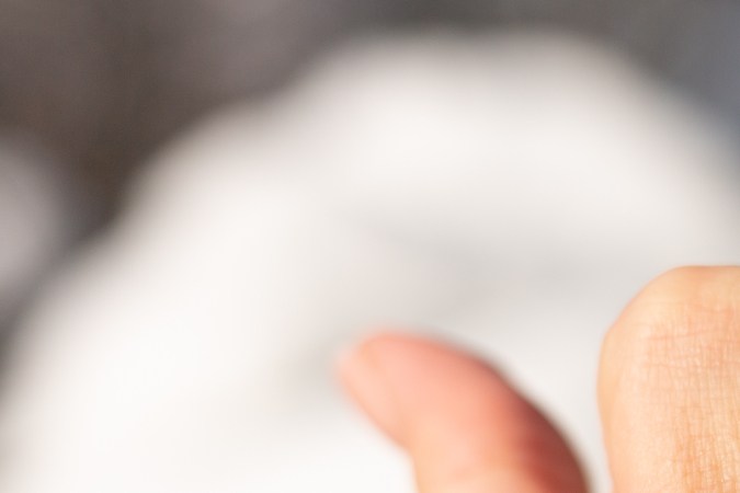 Uñas amarillas por hongos