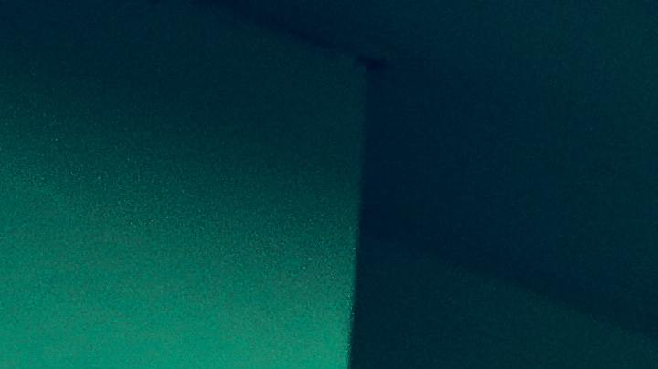 cirugía bariátrica, obesidad, Estar Mejor