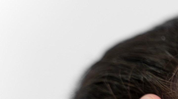 Trasplante de cabello