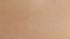 adicción a los opioides