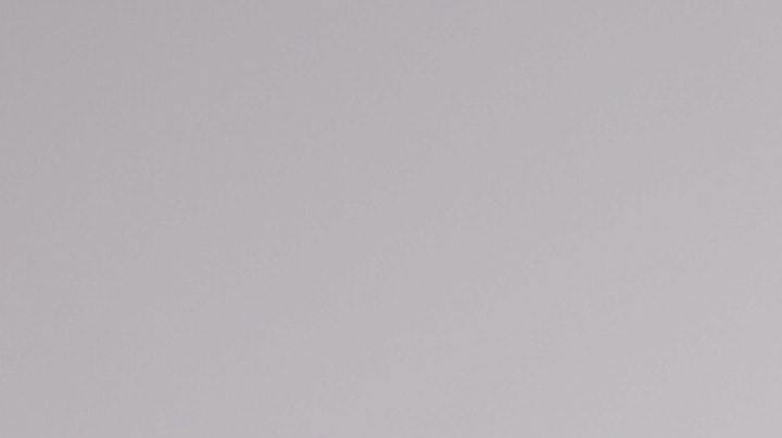 Labios agrietados , recomendaciones, Estar Mejor