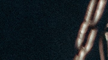 proteína animal, cáncer, Estar Mejor