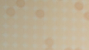 Qué significa soñar con piojos