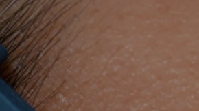 Infección de COVID-19