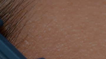 Infección de COVID-19