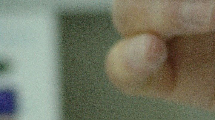 Cancer leucemia sistema inmune, Estar Mejor