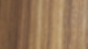 venas varicosas, váricen, dolor de piernas