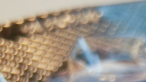 analgésicos, dolor crónico, Estar Mejor