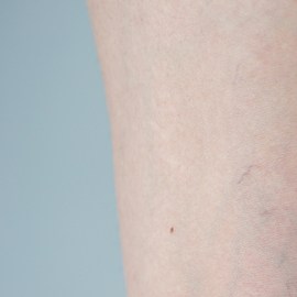 higado alertas piernas, Estar Mejor