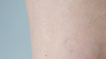 higado alertas piernas, Estar Mejor