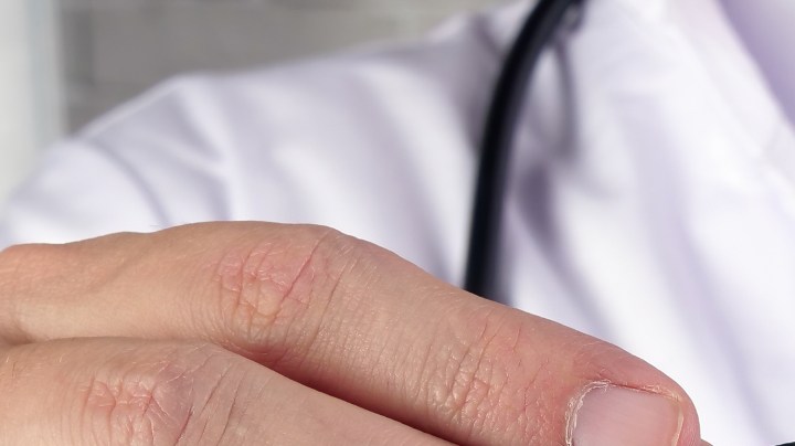 Consejos para prevenir la viruela del mono