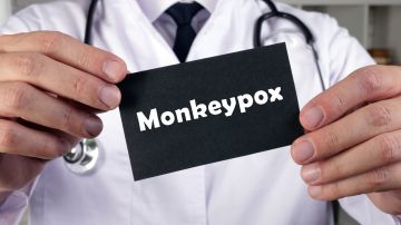 Consejos para prevenir la viruela del mono