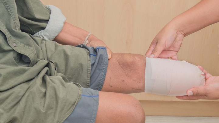 Diabetes riesgo de amputación