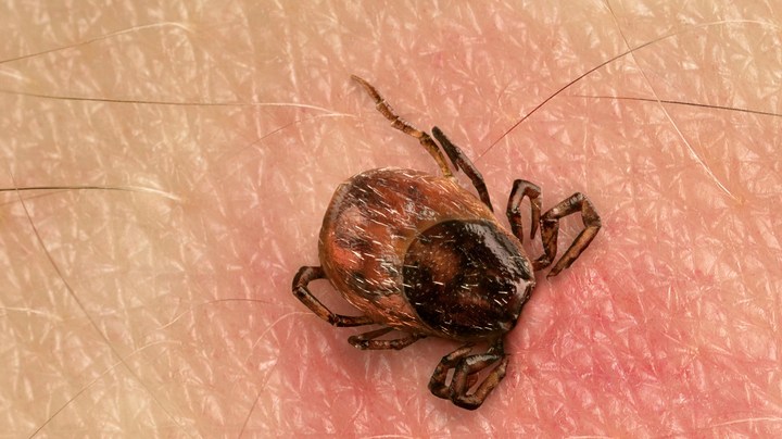 enfermedad de lyme, síntomas