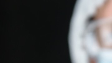 Viruela del Mono en la comunidad LGBTQI