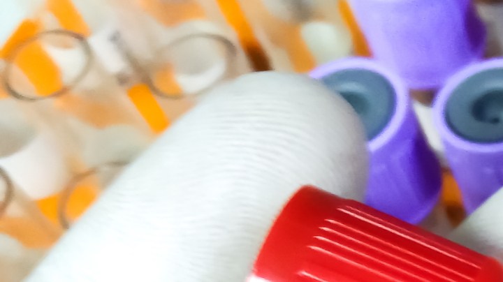 expertos analizan la viruela del mono