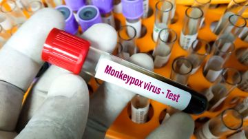 expertos analizan la viruela del mono