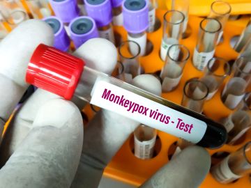 expertos analizan la viruela del mono
