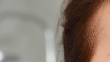 virus acabar con el acné