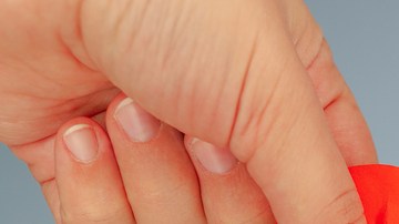 síndrome corazón roto