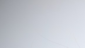 COVID prolongado alopecia libido