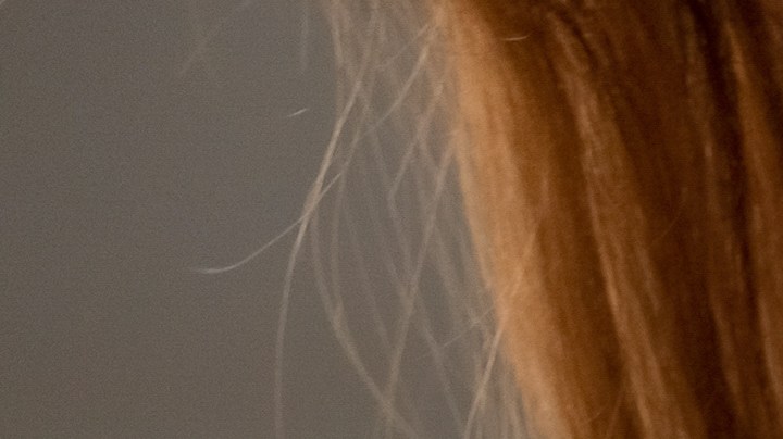 Cómo la intoxicación alimentaria pudiera contagiarse