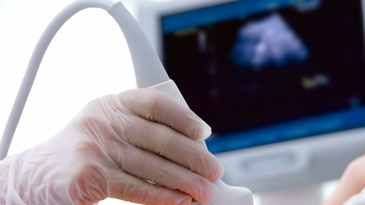 Fertilidad vecindario