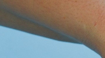 Qué es la fiebre del tomate