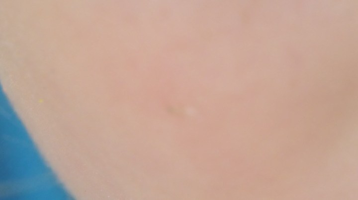 Los objetos que los niños pueden tragarse en un descuido