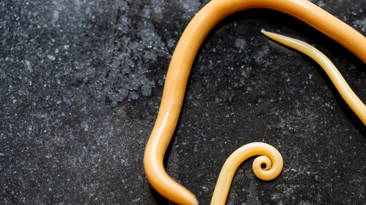 Eliminar lombrices y parásitos en el cuerpo remedios caseros