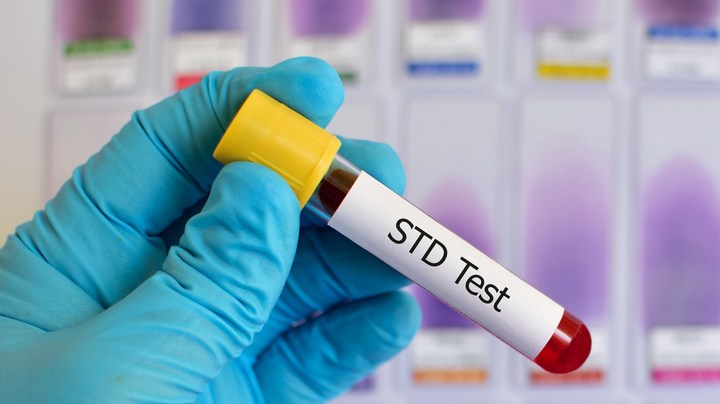 Gonorrea y sífilis prueba