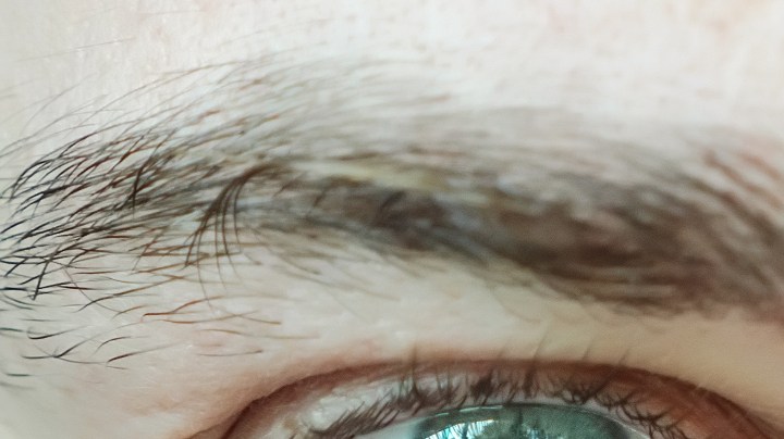 Remedios caseros para la conjuntivitis