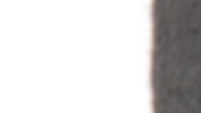 Cómo se puede revertir una vasectomía