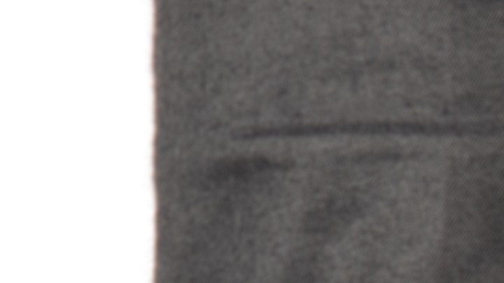 Cómo se puede revertir una vasectomía