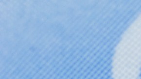 Vicks Vaporub para eliminar las várices