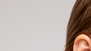 joyería que te da alergia