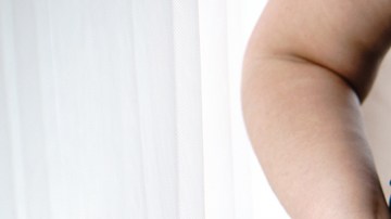 no engordar si estás tomando corticoides